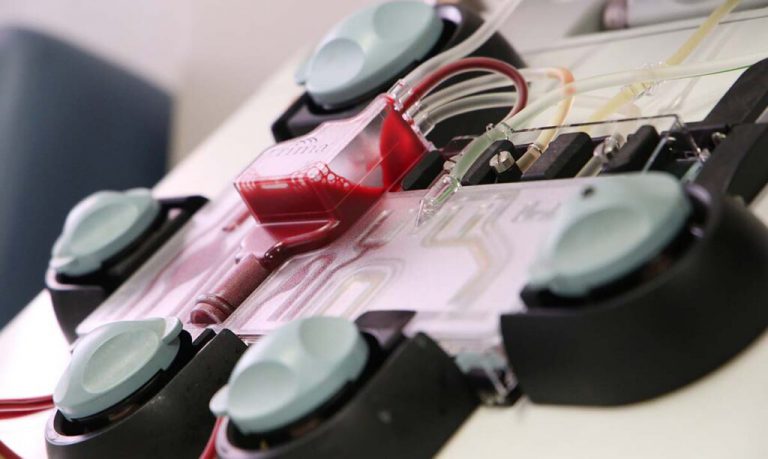 Donación de plasma: iniciativa solidaria en Tucumán