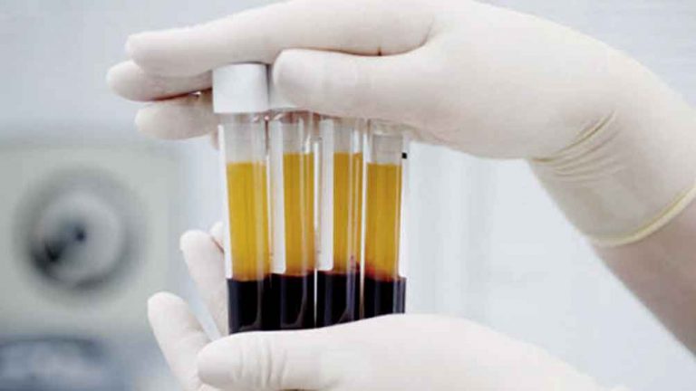 ¿El plasma sirve?: nuevos estudios sobre la seguridad de los tratamientos