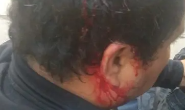 Padres a cuchillazos en Alderetes