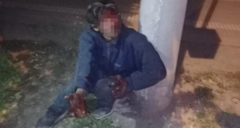 Only in Tucumán: no logró robar, pero provocó una explosión y dejó sin luz a un barrio entero