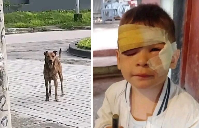 Un perro ingresó a una vivienda y atacó a un niño de 3 años en Concepción