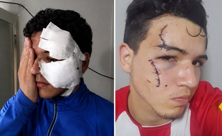 Delincuentes con tobilleras electrónicas atacan a un joven en Tafí Viejo y vuelven a ser detenidos