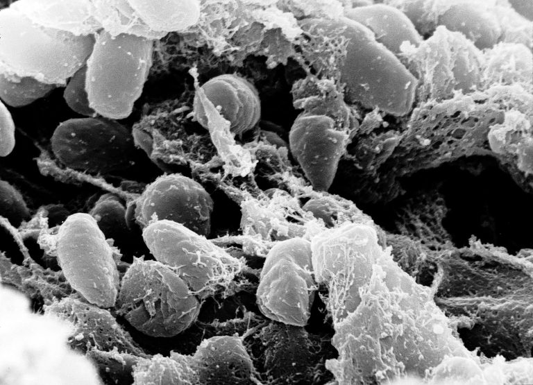 Microscopía electrónica de Yersinia pestis